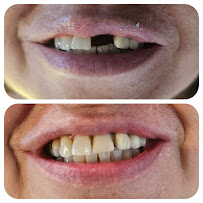INFINITE SMILE 8 Odontologia Personalizada
