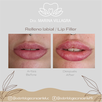 INFINITE SMILE 8 Odontologia Personalizada