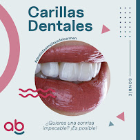 Dentistas en Playa Del Carmen