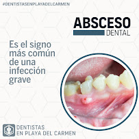 Dentistas en Playa Del Carmen