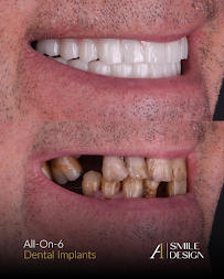 A1 Smile Design