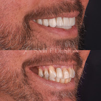 A1 Smile Design