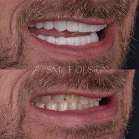 A1 Smile Design