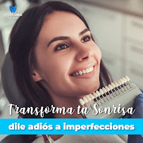 Carillas Dentales en Monterrey - Dental Smile Clinic