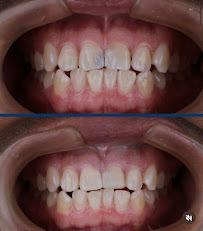 Central Dental
