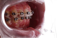 Central Dental