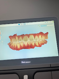 Zental Odontología - Sertoma - Clínica Dental Monterrey