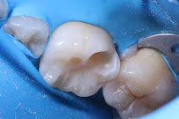 Zental Odontología - Sertoma - Clínica Dental Monterrey