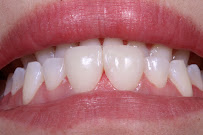 Zental Odontología - Sertoma - Clínica Dental Monterrey