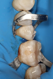 Zental Odontología - Sertoma - Clínica Dental Monterrey