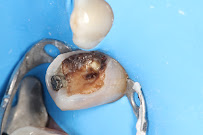 Zental Odontología - Sertoma - Clínica Dental Monterrey
