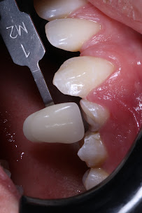 Zental Odontología - Sertoma - Clínica Dental Monterrey
