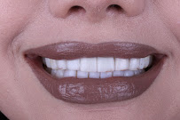 Zental Odontología - Sertoma - Clínica Dental Monterrey