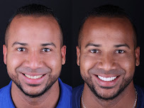 Zental Odontología - Sertoma - Clínica Dental Monterrey