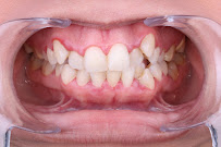 Zental Odontología - Sertoma - Clínica Dental Monterrey