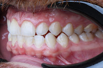 Zental Odontología - Sertoma - Clínica Dental Monterrey