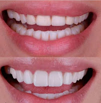 Alva Clínica Dental Plaza Marina