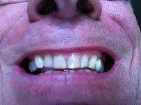 Dental Solutions Puerto Vallarta