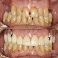 Dental Solutions Puerto Vallarta