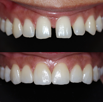 Dental Solutions Puerto Vallarta