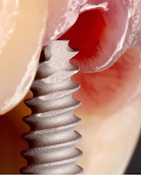 Boca Oficina Dental