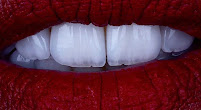 Boca Oficina Dental