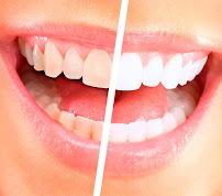 Boca Oficina Dental