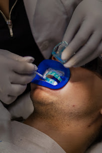 DentalEstetic Puerto Vallarta