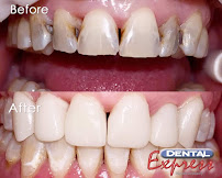 Dental Express