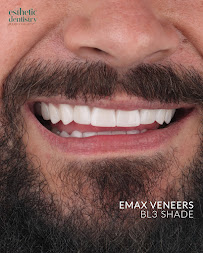 Esthetic Dentistry in Puerto Vallarta