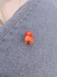 Clínica Dental la Zapopana (Sucursal El Pitillal)