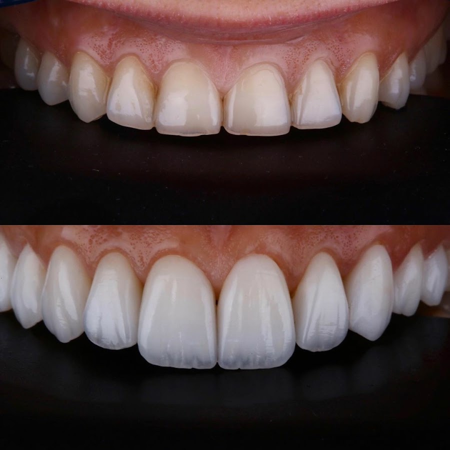 Smile Vallarta Dentist - dental clinic in Puerto Vallarta, Mexico