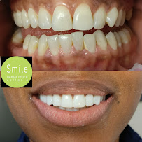 Smile Vallarta Dentist