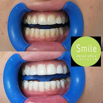 Smile Vallarta Dentist