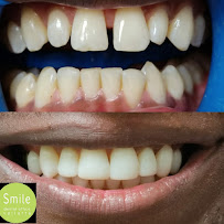 Smile Vallarta Dentist