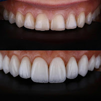 Smile Vallarta Dentist in Puerto Vallarta, Mexico