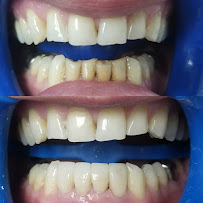 Smile Vallarta Dentist