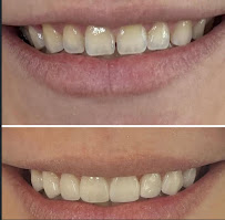 Castillo Dental Care