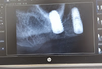 Dental Life Puerto Vallarta🍏