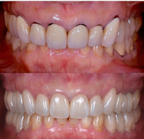 Dental Life Puerto Vallarta🍏