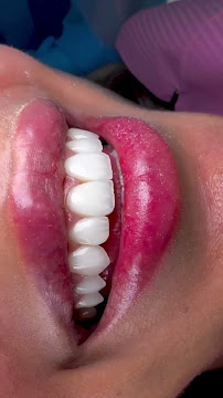 International Dental Center PV Cosmetic Dentistry and Dental Implants