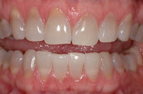 International Dental Center PV Cosmetic Dentistry and Dental Implants