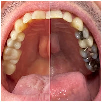 International Dental Center PV Cosmetic Dentistry and Dental Implants