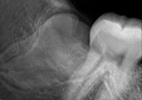 DENTAL SIGN
