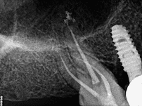 DENTAL SIGN