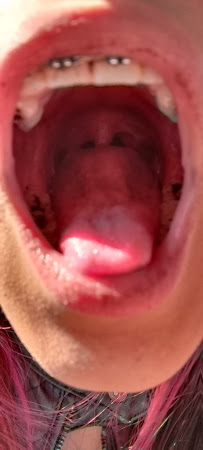 Dental Health Care