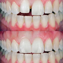 Dentist Cd Juarez - Creadent