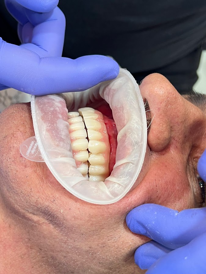 Gio Dental & Med Spa - dental clinic in Juarez