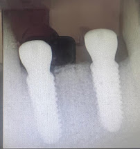 Gio Dental & Med Spa