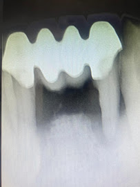 Gio Dental & Med Spa